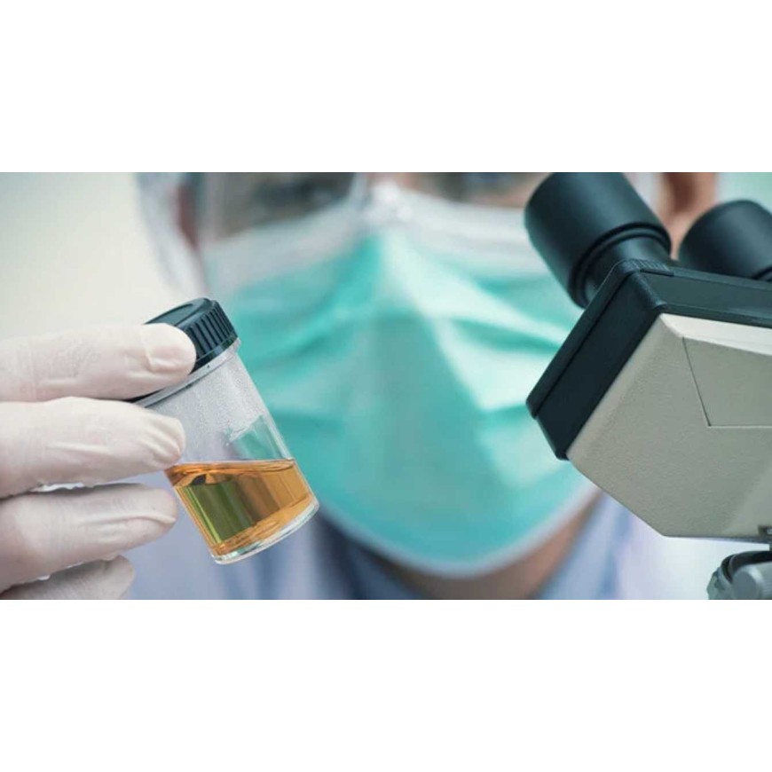 Unsere Tipps für einen erfolgreichen THC-Urintest und die Rückerlangung Ihres Führerscheins!