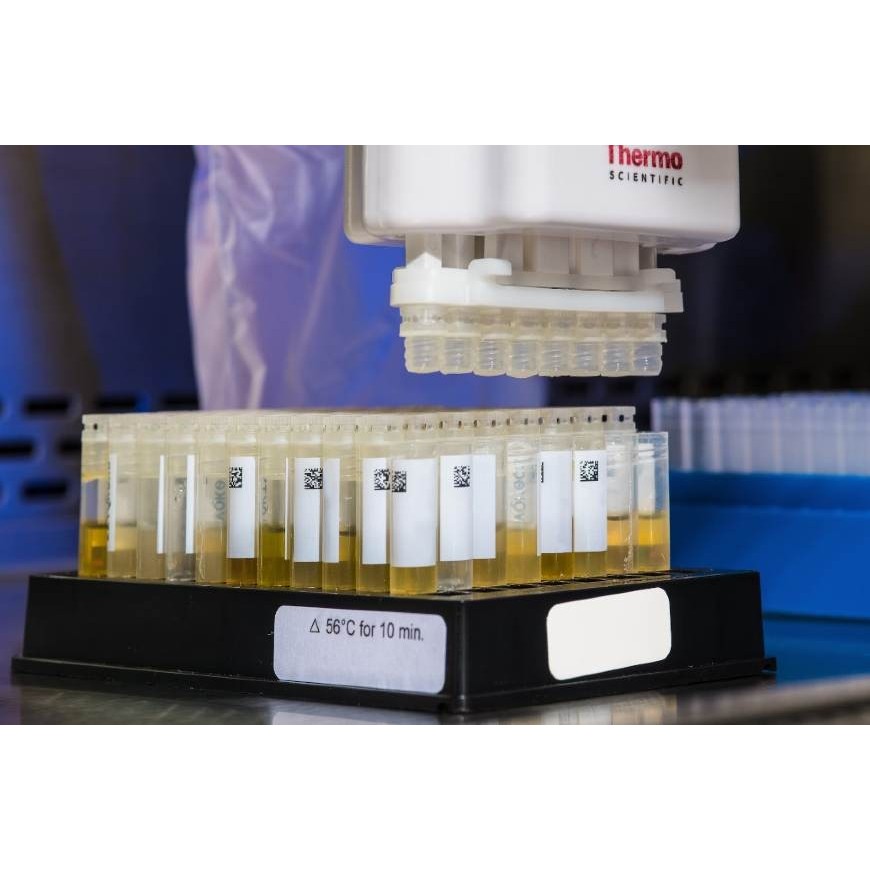 Drogentests: Welcher ist der richtige?